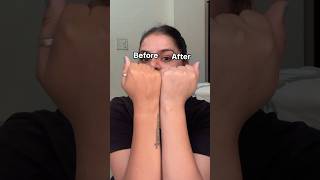 "Before: Dry and tired skin.After: Soft, fresh, and glowing !✨ #plix#beautyadvice #skincare