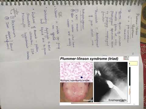 #plummer Vinson Syndrome notes #SHORTS