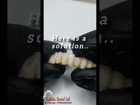 💔 Its heartbreaking but hav to find a way out #dentaltechnician #dentist #dental #dentalcare #viral