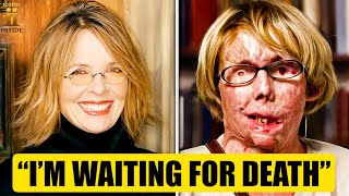 25 Famous Actors Nearing Death from Cancer Then and Now 2025