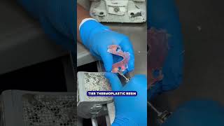 Replacing Your Teeth Has Never Been Easier (or More Affordable)