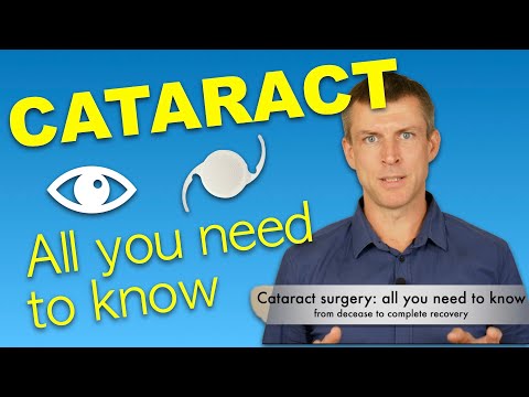 Cataract surgery: all you need to know about vision recovery