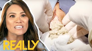 Dr Lee's MOST INTENSE Cyst Removal Surgeries! | Dr. Pimple Popper