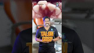 டேலனின் முகடு!!! Talon Cusp! | Dr.Karthikeyan | Denta Kings