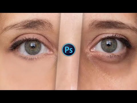 Remove Dark Circles Naturally in Photoshop at 1 min.. || PixxDel ||