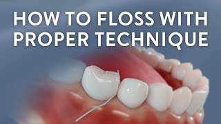 Beyond Brushing: How To Floss With Proper Technique