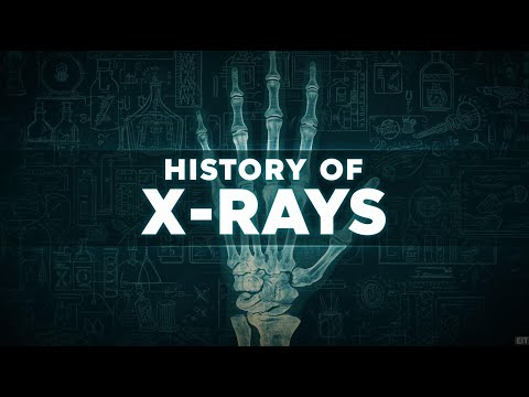 The Complete History of X-Rays | From Wilhelm Röntgen to Modern Medical Imaging