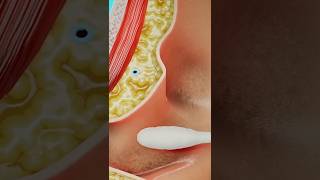 Why You Should Stop Using Q Tips