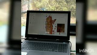 Digital Impression for Aligners