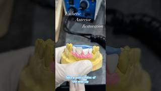 Anterior composite restoration steps🦷👩‍⚕️#dentaleducation