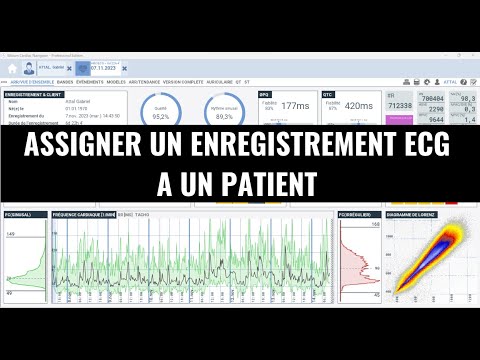 Assigner un enregistrement ECG à un patient/client