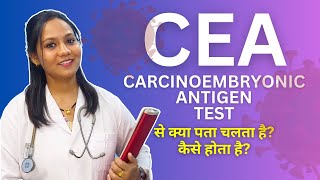 What is Carcinoembryonic Antigen Test? CEA Test Explained by Doctor Varun