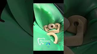 #dentist #worldwidedentist #dentistdoctor #rootcanalspecialist #dentistrylove