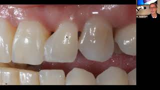 Bioclear Matrix | International Webinar Part 2