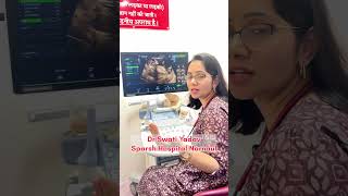 Pregnancy ultrasound| NT scan in 3 months pregnant |#ultrasound #pregnant #short #babyscan