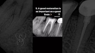 Step by step guide for Re Root canal treatment #composite #smiledentist #rootcanalspecialist