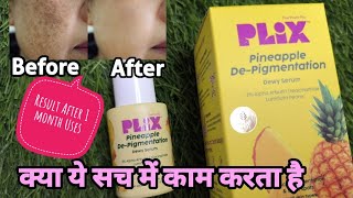 Plix Pineapple De- Pigmentation Dwey Serum|क्या ये सच में काम करता है|Plix Serum#divasglambyshobha