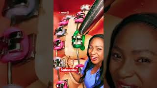 Does it hurt to change braces colors? #shorts #bracescolors