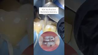 Biomimetic Dentistry #biomimeticdentistry #restorativedentistry #dentist