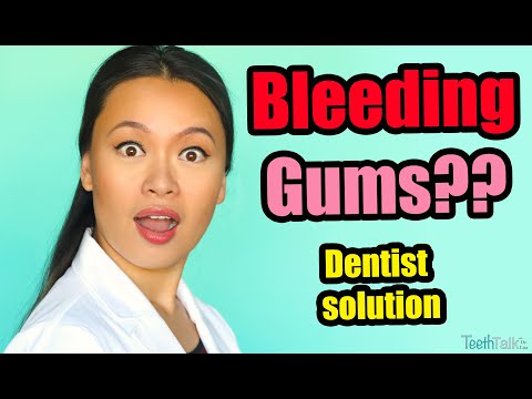 Bleeding Gums? What a Dentist recommends.