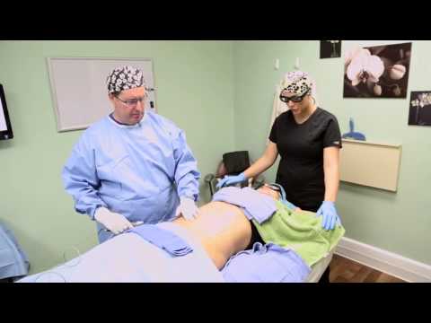 Young Medical Spa® - SmartLipo™: Real Patients. Real Results.
