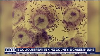 E Coli outbreak in King County, 6 cases in June | FOX 13 Seattle