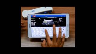 Sonon 300C : Tutorial
