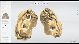 How to order? Dental tech. Lectures - Customized abutment