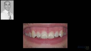 The Biomimetic Approach to Saving Teeth Minimally Invasive Restorations
