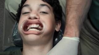 Congrats Clayton: A Smooth Experience Getting Braces On By Dr.Gerling of McAllen Orthodontics Group