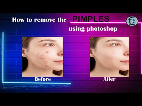 How to remove pimples using #photoshop