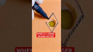 Longer Surgical Incision For Better Skin Healing⁉️ #shorts
