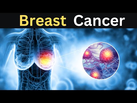 How Breast Cancer Surgery Is Performed | 3D Animation | Breast cancer treatment