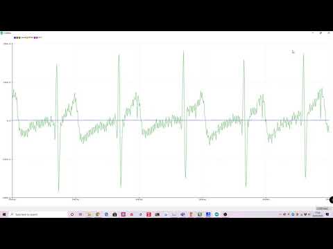 RAW ECG via UART Stream - Max30003 AFE nRF52832 MCU BLE Wearble Health Monitor Project