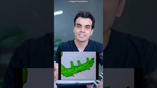 Digital Implant Impression Tip