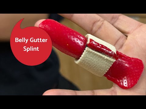 Belly Gutter Splint