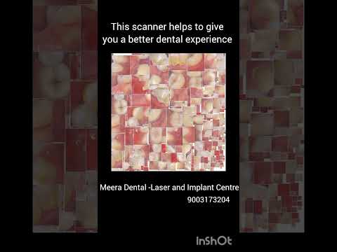Intraoral scanner -Embracing digital transformation #chennaidentist #chrompet