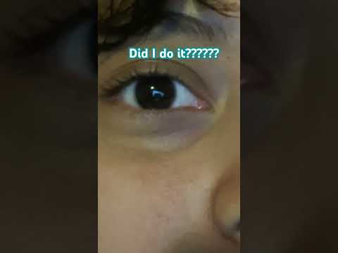 Spider blink?? #spiderblink