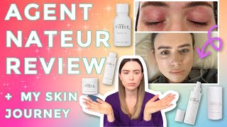 AGENT NATEUR | Full Line Review + My Skincare Journey (Melasma, Eczema, Scarring, Acne)