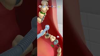#asmr #animation #treatment #gaming #treatmentforallbodyparts  #games #relaxinggames #funny #relax