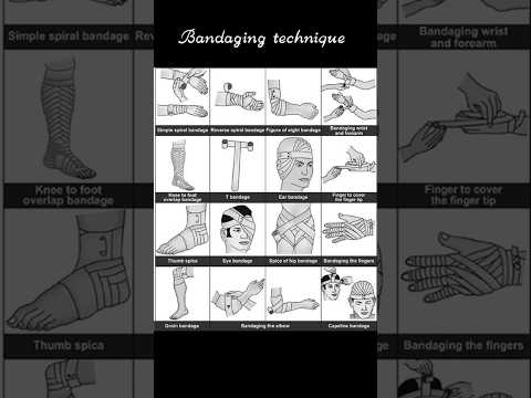 Bandaging technique #bandagingtechnique #bandage #medicos #firstaid #shorts #fon #bscnursing