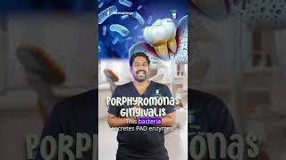 ஈறு நோயால் மூட்டு வலியா? - Gum Disease and Rheumatoid Arthritis | Dr.Karthikeyan | Denta Kings