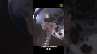 Brain 10 Second Band Ho Gaya To? 😱 | Dangerous Human Fact