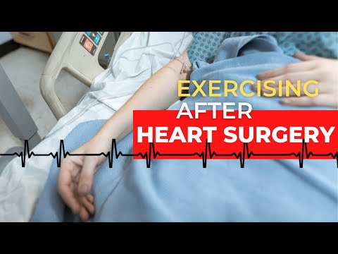 How to Exercise After Heart Surgery