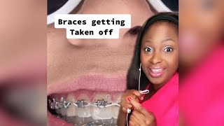 POV: Younare getting your braces removed #reaction #hygienist #bracesoff