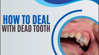 How to deal with dead tooth (3 effective treatments)