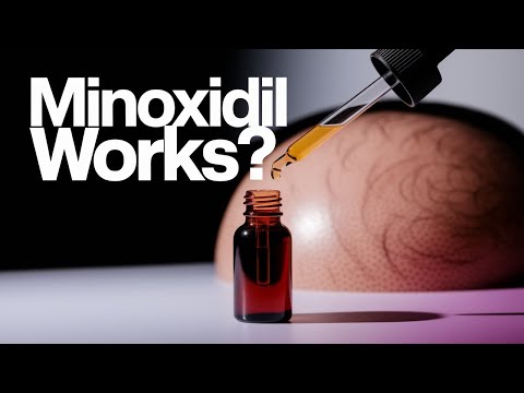 Minoxidil for Hair Loss: Does It Work? Evidence-Based Facts!