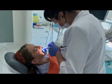 Teeth whitening