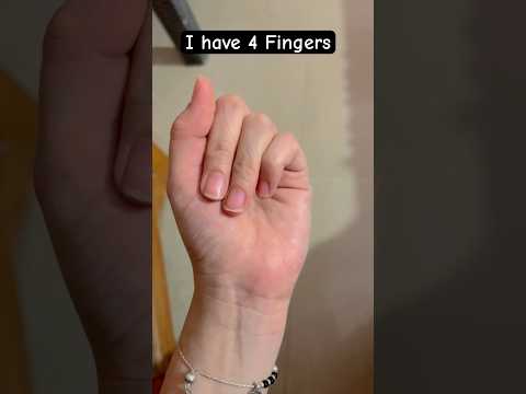 I have only 4 Fingers😇🥳 #funny #shorts #shortvideo #comedyshorts #tiktok