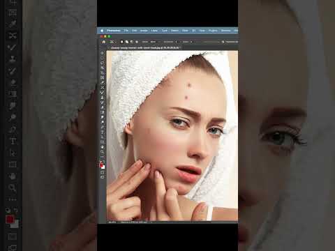 How to remove acne #shorts #photoshop #viral